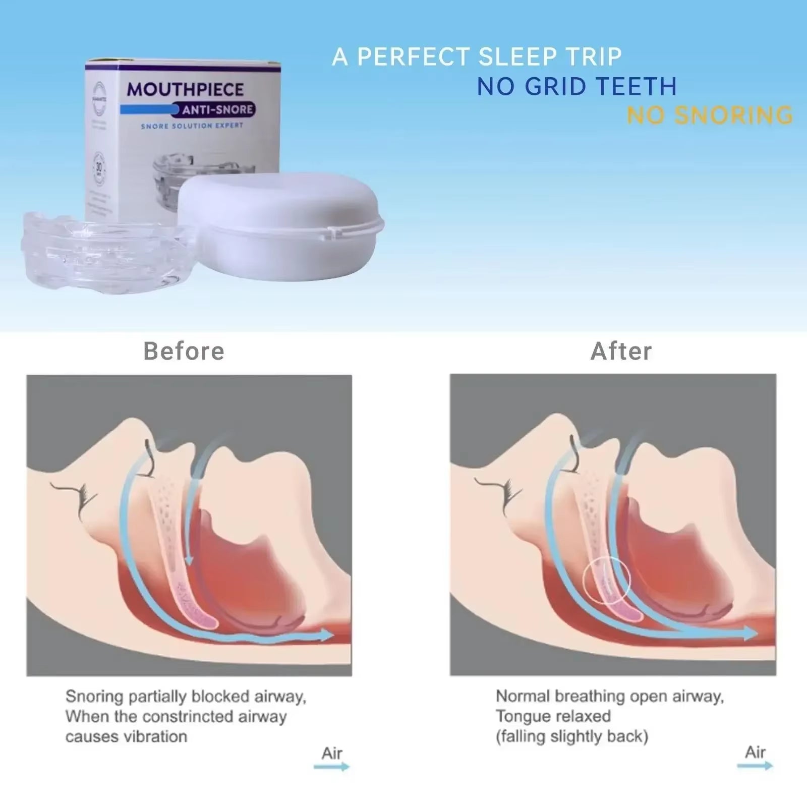 Anti-Snoring Mouth Guard Adjustable 